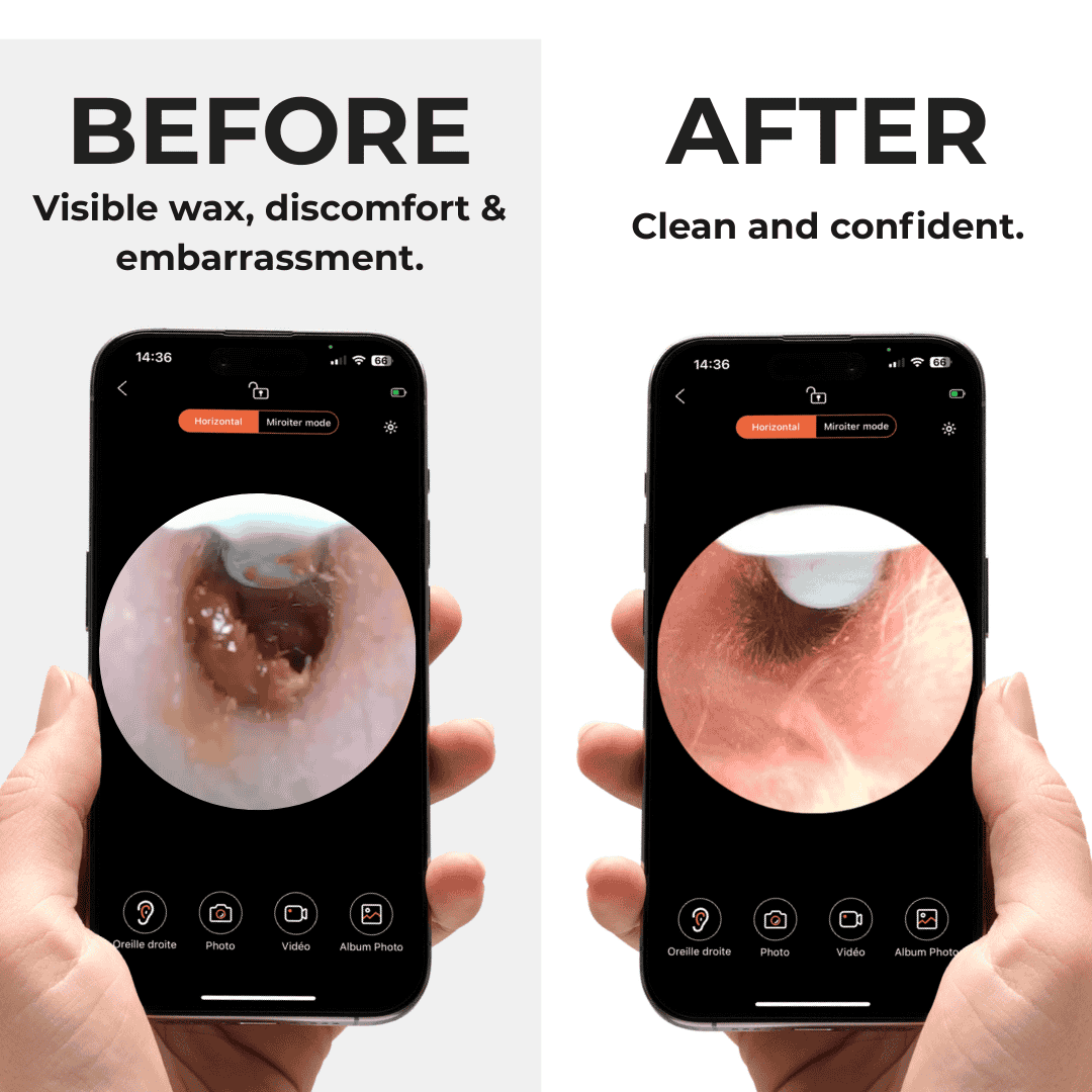 Earo Vision 2.0