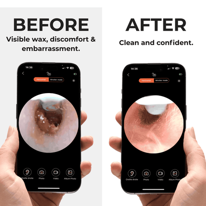 Earo Vision 2.0